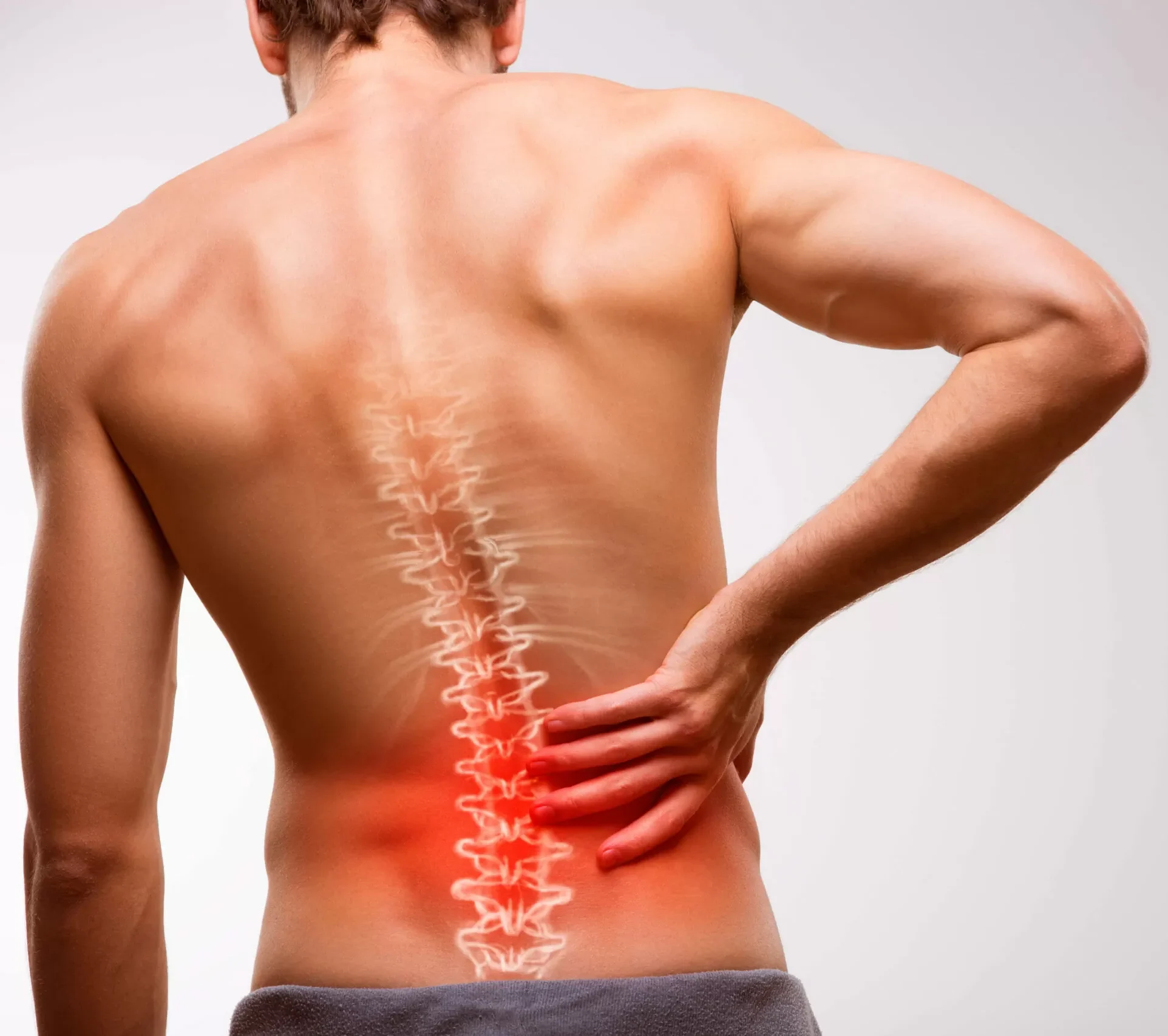 Sciatica